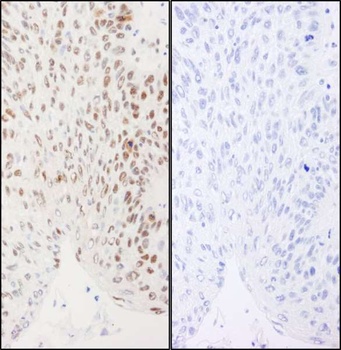 Rabbit Phospho XRCC1 (S461) Antibody