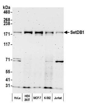 Rabbit SETDB1 Antibody