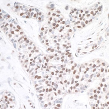 Rabbit ASH2 Antibody