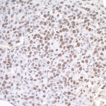 Rabbit ASH2 Antibody