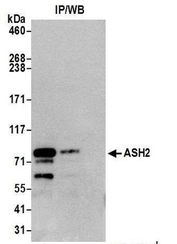 Rabbit ASH2 Antibody