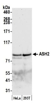 Rabbit ASH2 Antibody