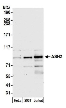 Rabbit ASH2 Antibody