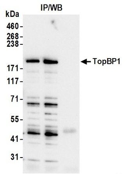 Rabbit TopBP1 Antibody