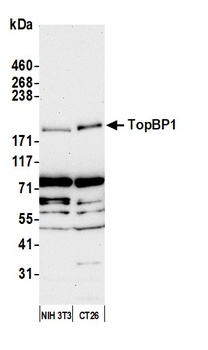 Rabbit TopBP1 Antibody