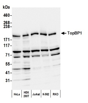 Rabbit TopBP1 Antibody
