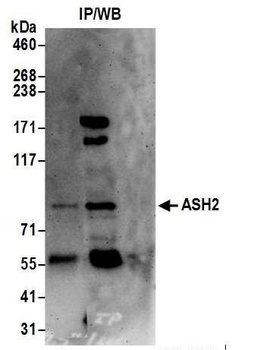 Rabbit ASH2 Antibody
