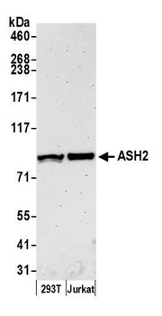 Rabbit ASH2 Antibody