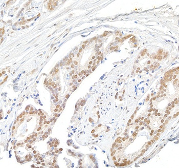 Rabbit Menin Antibody