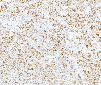 Rabbit Phospho MCM2 (S108) Antibody