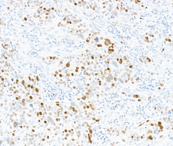 Rabbit Phospho MCM2 (S108) Antibody