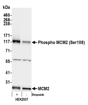 Rabbit Phospho MCM2 (S108) Antibody