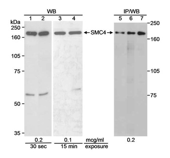 Rabbit SMC4 Antibody