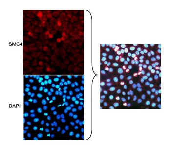 Rabbit SMC4 Antibody