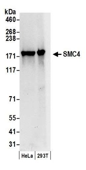 Rabbit SMC4 Antibody