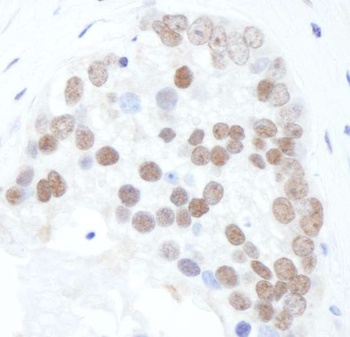 Rabbit Phospho XRCC1 (S518/T519/T523) Antibody