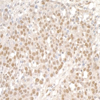 Rabbit SMC1 Antibody