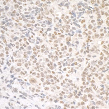Rabbit SMC1 Antibody
