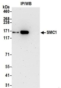 Rabbit SMC1 Antibody