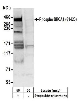 Rabbit Phospho BRCA1 (S1423) Antibody