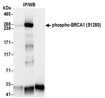 Rabbit Phospho BRCA1 (S1280) Antibody