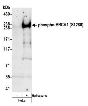 Rabbit Phospho BRCA1 (S1280) Antibody