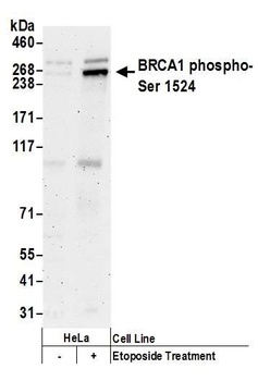 Rabbit Phospho BRCA1 (S1524) Antibody