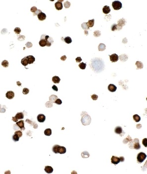 Rabbit anti-Myc Tag Recombinant Monoclonal Antibody