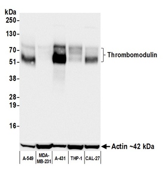 Rabbit anti-Thrombomodulin Recombinant Monoclonal Antibody