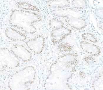 Rabbit anti-KLF4 Recombinant Monoclonal Antibody