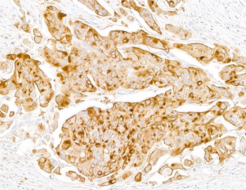Mouse Uroplakin III Monoclonal Antibody