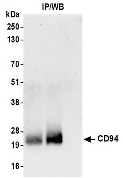 Rabbit CD94 Recombinant Monoclonal Antibody