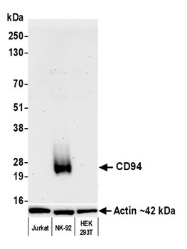 Rabbit CD94 Recombinant Monoclonal Antibody