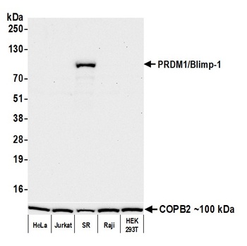 Rabbit PRDM1/Blimp-1 Recombinant Monoclonal Antibody