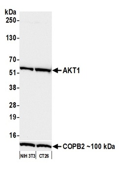 Rabbit AKT1 Recombinant Monoclonal Antibody