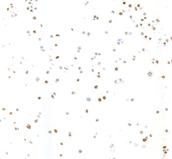 Rabbit anti-KLF5 Recombinant Monoclonal Antibody