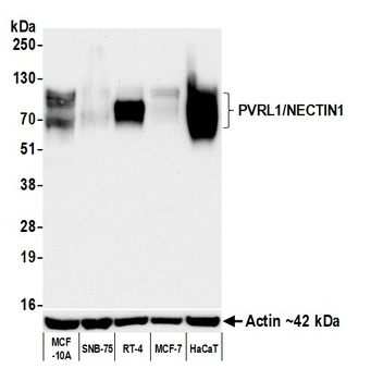 Rabbit anti-PVRL1/NECTIN1 Recombinant Monoclonal Antibody