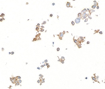 Rabbit B7-H6 Recombinant Monoclonal Antibody