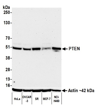 Rabbit PTEN Recombinant Monoclonal Antibody
