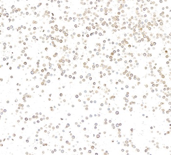 Rabbit anti-CD36 Recombinant Monoclonal Antibody