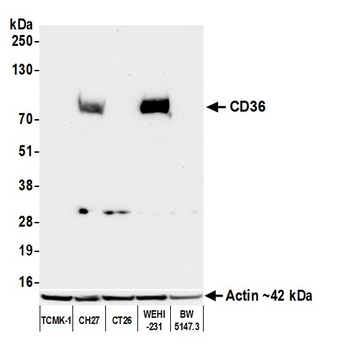 Rabbit anti-CD36 Recombinant Monoclonal Antibody