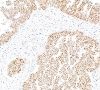 Mouse PAX8 Monoclonal Antibody