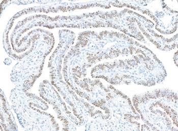 Mouse PAX8 Monoclonal Antibody
