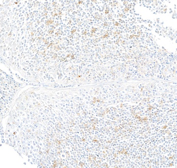 Rabbit IFN-gamma Recombinant Monoclonal Antibody