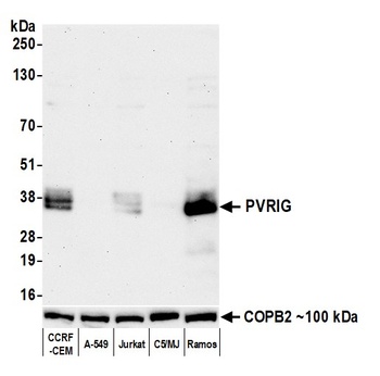 Rabbit PVRIG Recombinant Monoclonal Antibody