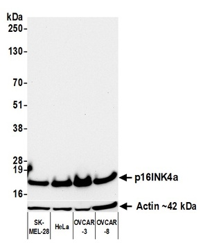Mouse p16INK4a Recombinant Monoclonal Antibody