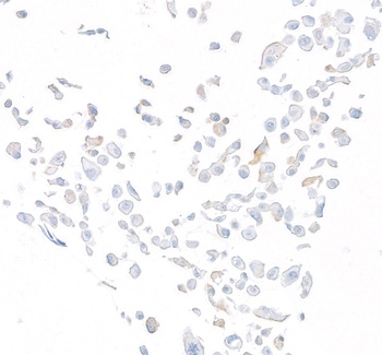 Rabbit DPP4/CD26 Recombinant Monoclonal Antibody