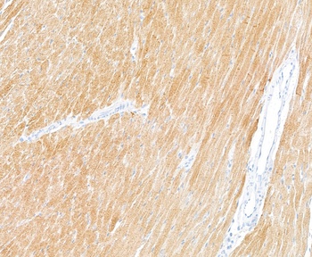 Rabbit Troponin I Recombinant Monoclonal Antibody