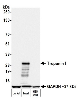Rabbit Troponin I Recombinant Monoclonal Antibody