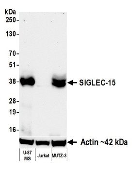 Rabbit SIGLEC-15 Recombinant Monoclonal Antibody